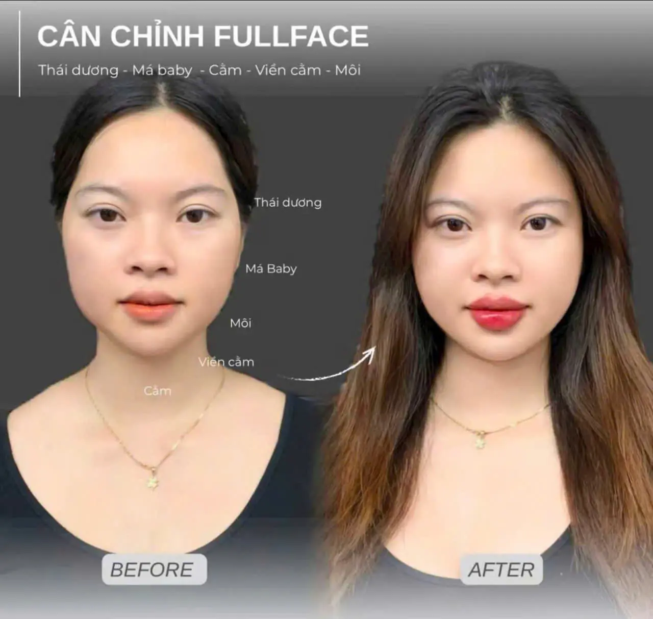 Cân chỉnh Fullface