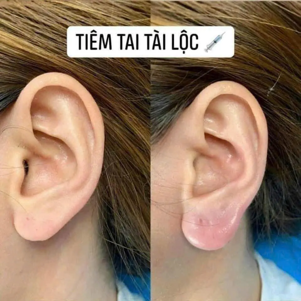 thường theo chiều ngang chiều dọc