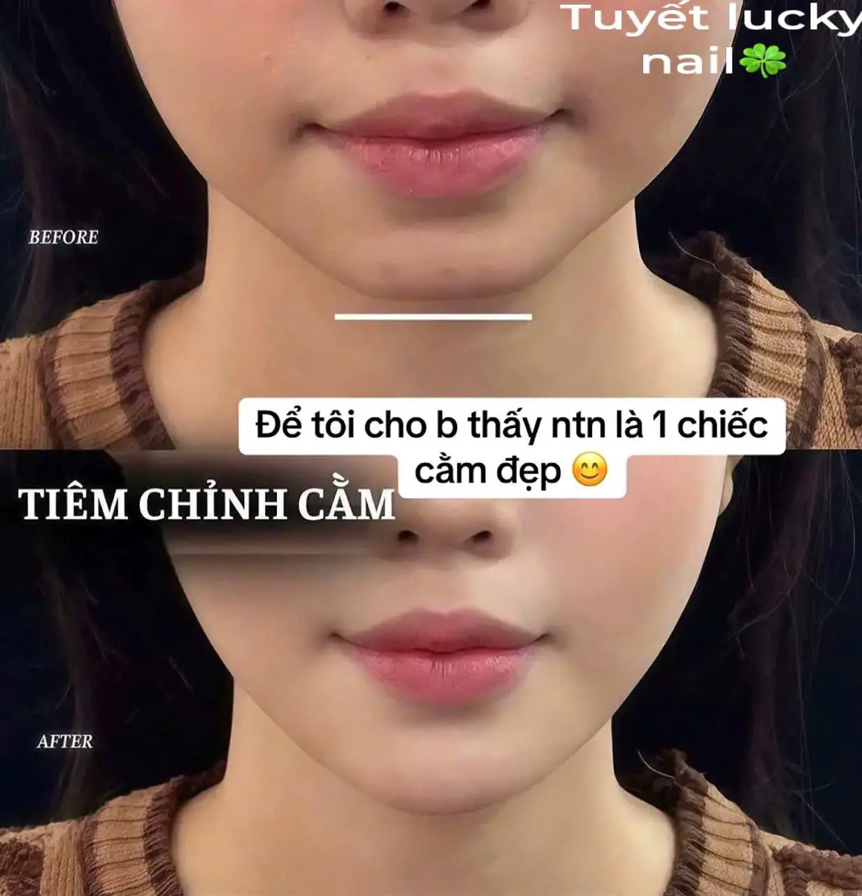 Spa - Trị Liệu 